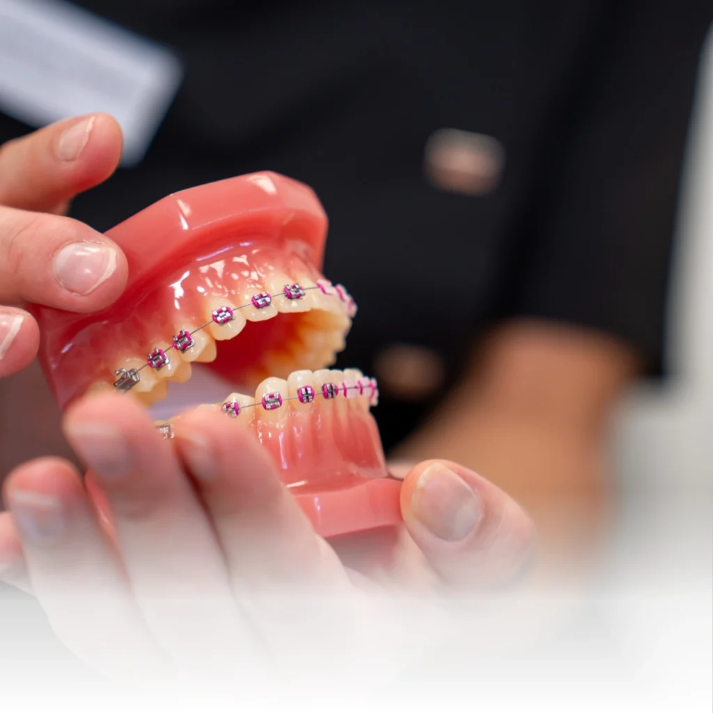 Ortodonzia 77 Apparecchio dentale a Verona